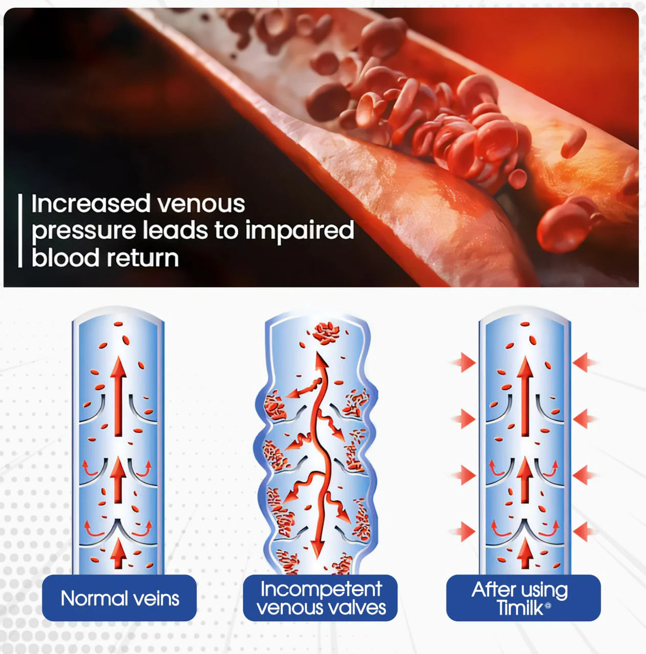 ⏰Last Day Promotion: 60% OFF🔥Cvreoz® VenoAid Varicose Vein Spray