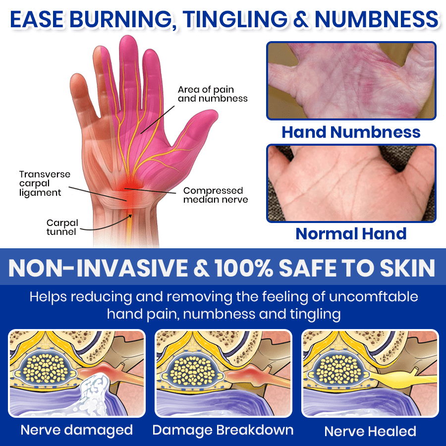 🦵🏻 CVREOZ® NumbEase Neuropathy Treatment Spray 💙 HOT SALE 60% OFF 🔥