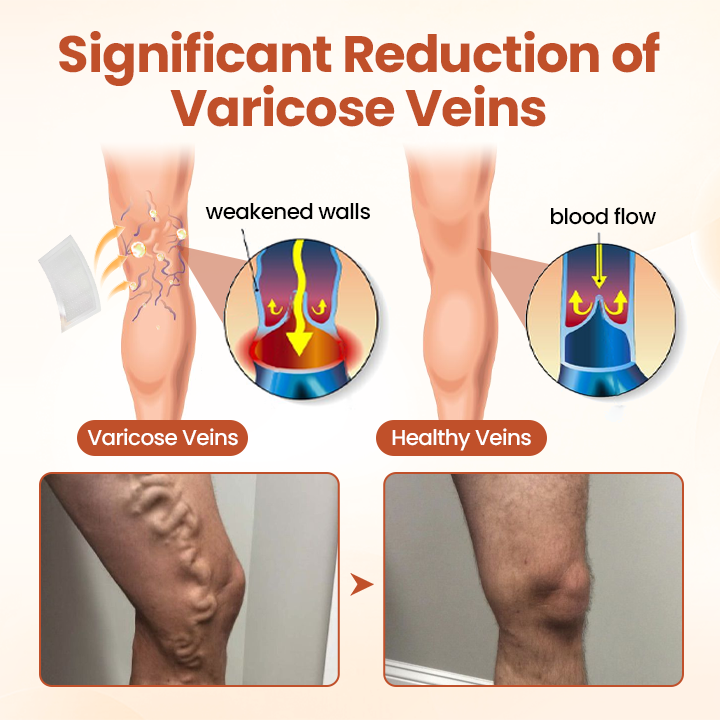 CVREOZ® VeinTarget Nanotech Microneedle Patch