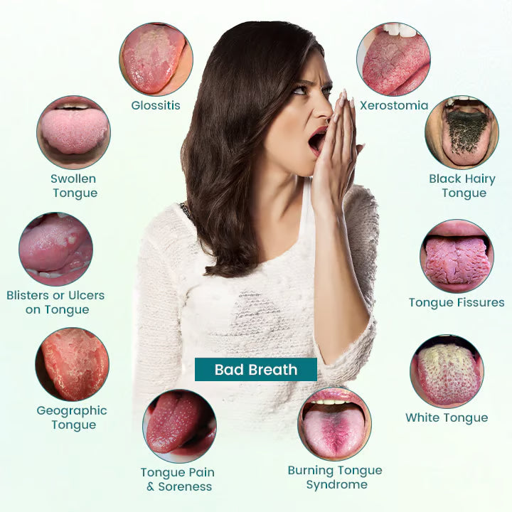 CVREOZ® GlosShield Tongue Repair Spray