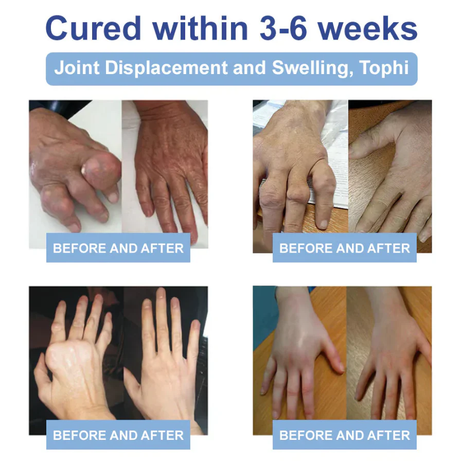 CVREOZ® Advanced Magnesium Pain Relief Cream 💥 Last-Day Promotion: 60% Off 💥
