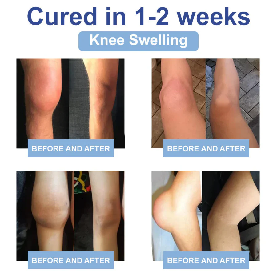 CVREOZ® Advanced Magnesium Pain Relief Cream 💥 Last-Day Promotion: 60% Off 💥