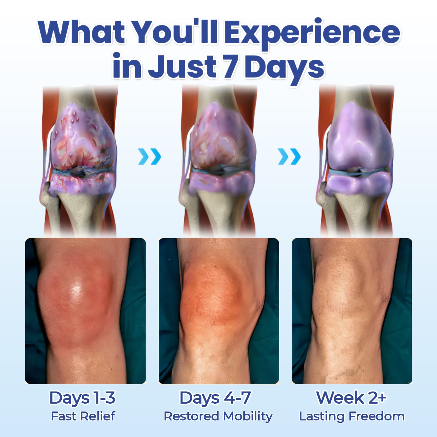 CVREOZ® Advanced Magnesium Pain Relief Cream 💥 Last-Day Promotion: 60% Off 💥