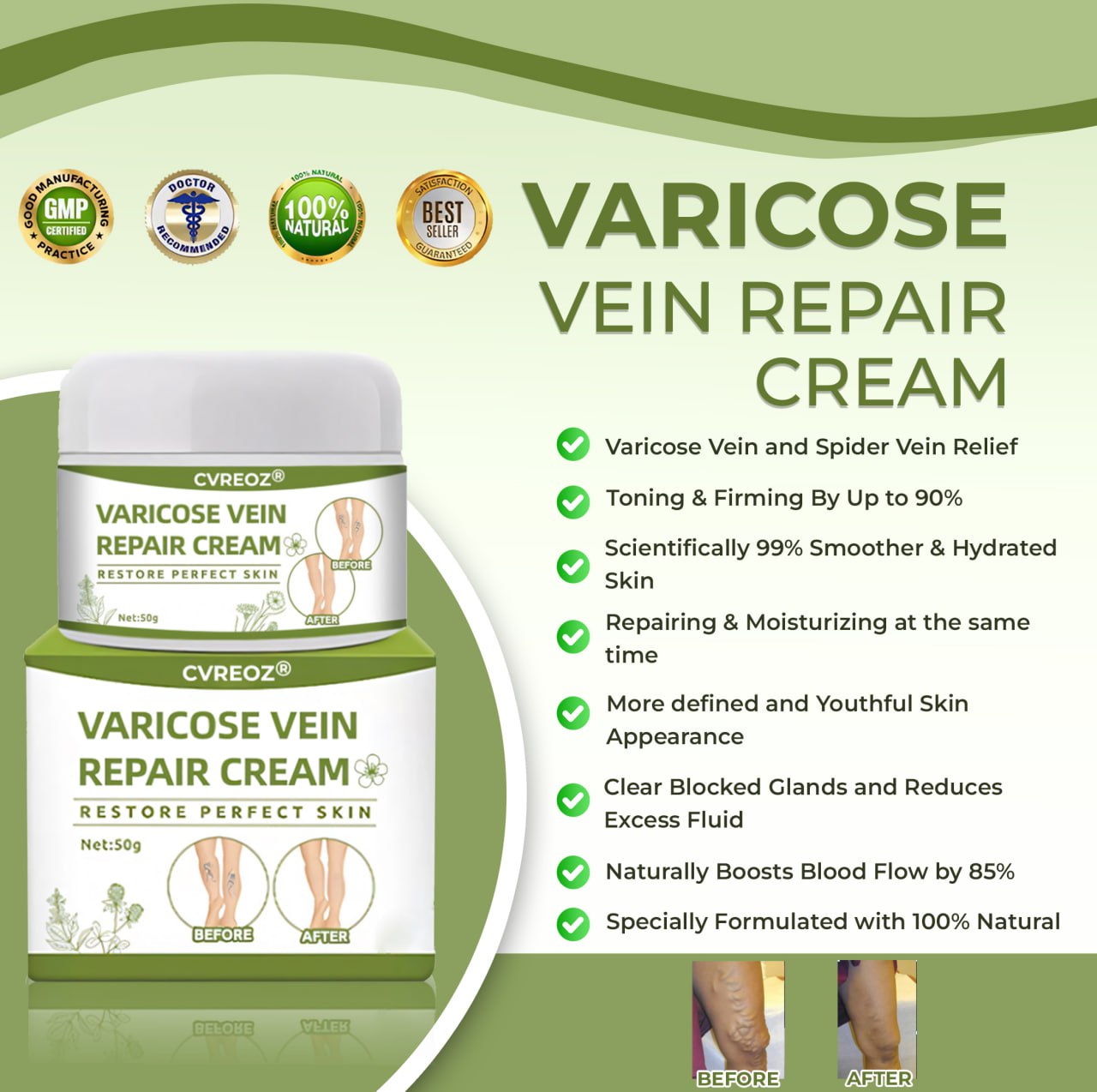 đ„ Last Day Promotion: 60% OFF đ„ CvreozÂź Varicose Veins Healing Cream