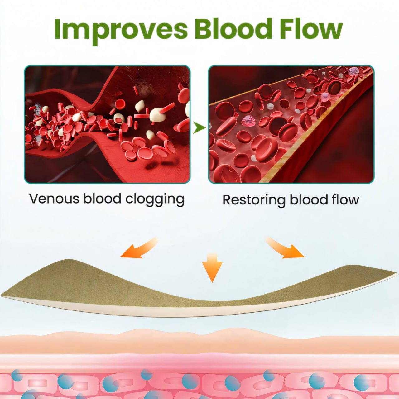 đ„ Last Day Promotion: 60% OFF đ„ CvreozÂź Varicose Veins Healing Cream