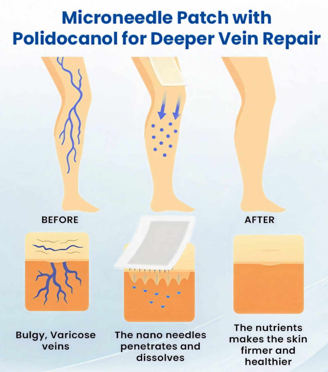 Cvreoz® Varicose Veins Patch🔥Last Sale: 60% OFF⏰