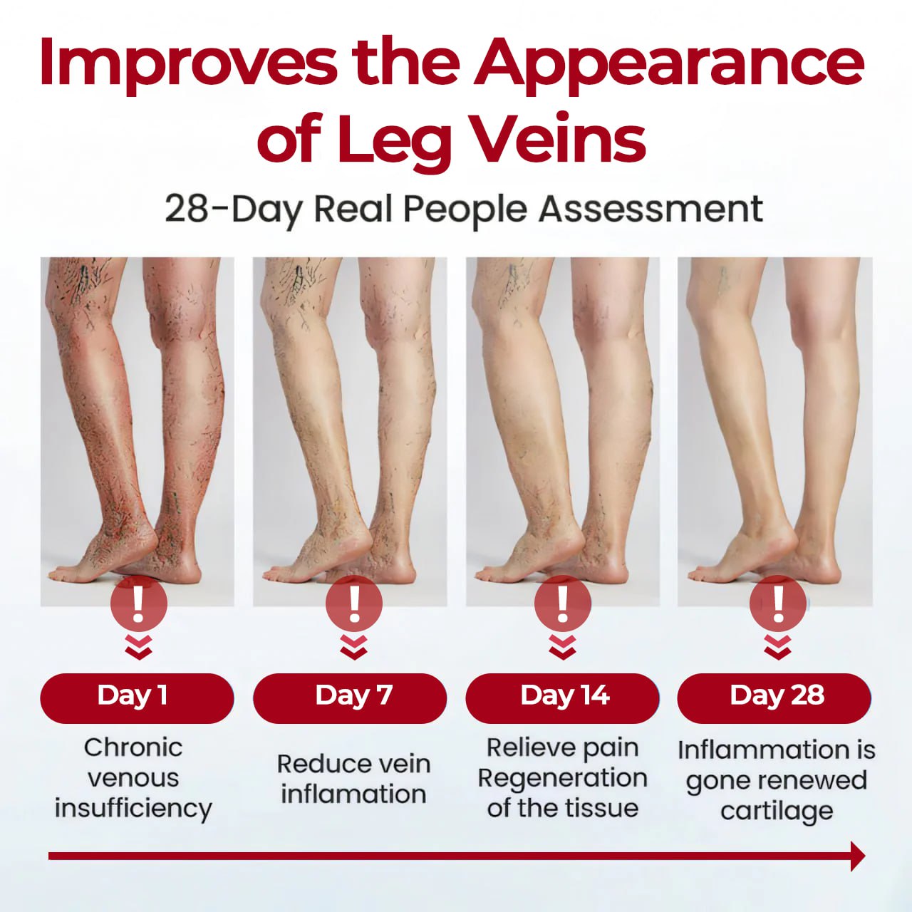 CVREOZ® Varicose Veins Patch Ultra