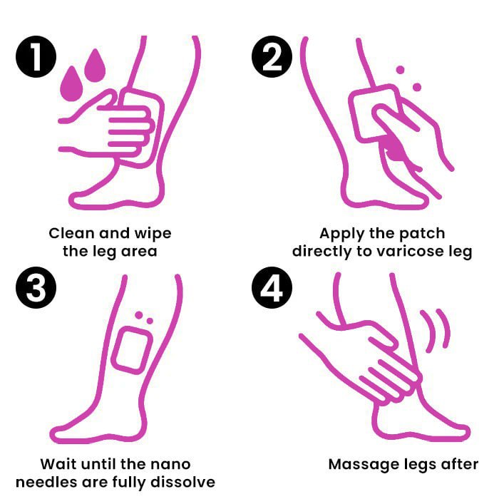 🩷 CVREOZ® VeinFlow Advanced Varicose Vein Patch 🦵🏻UP TO 60% OFF 🔥