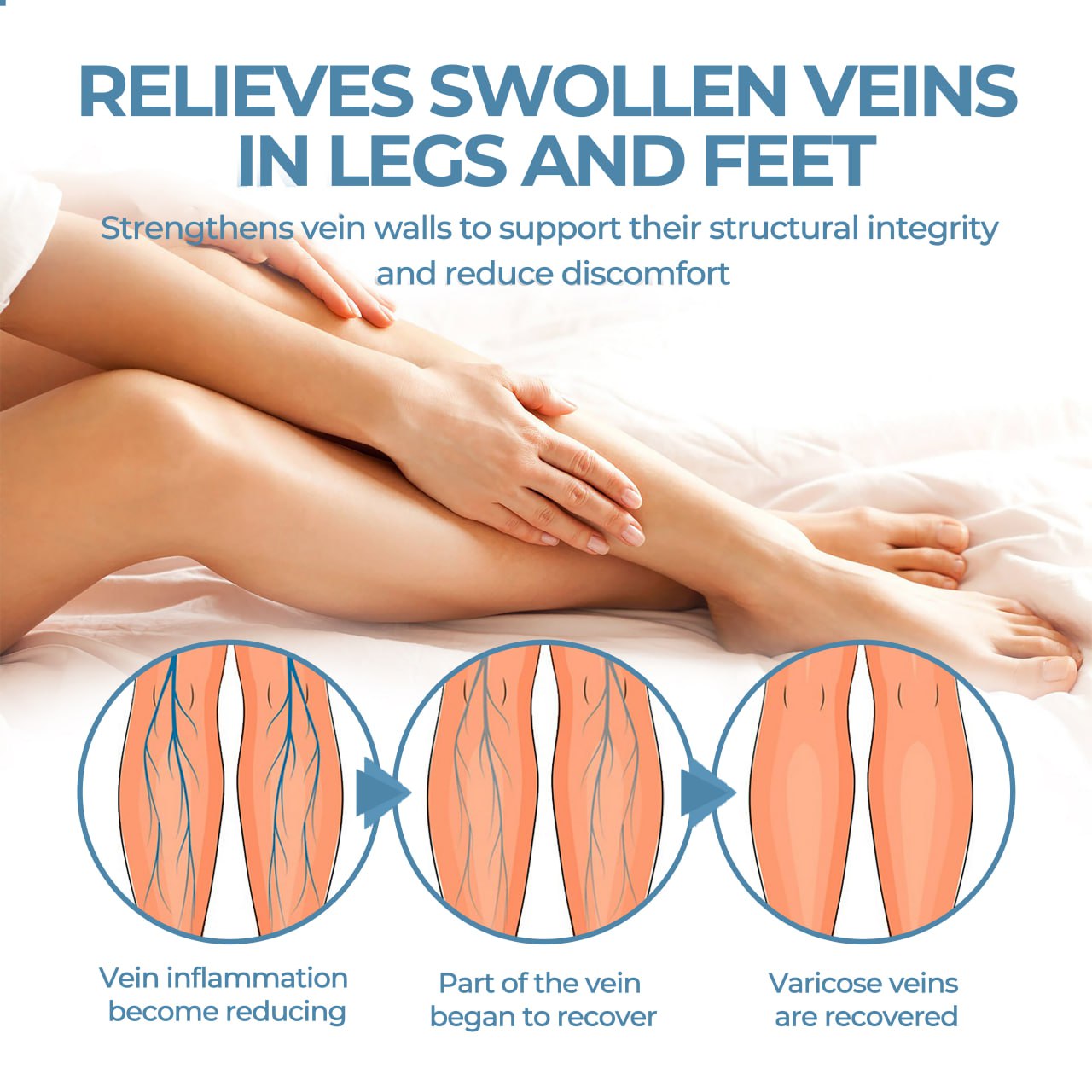 🔥Last Deal: 60% Off🔥 CVREOZ® Herbal Relief Varicose Vein Spray