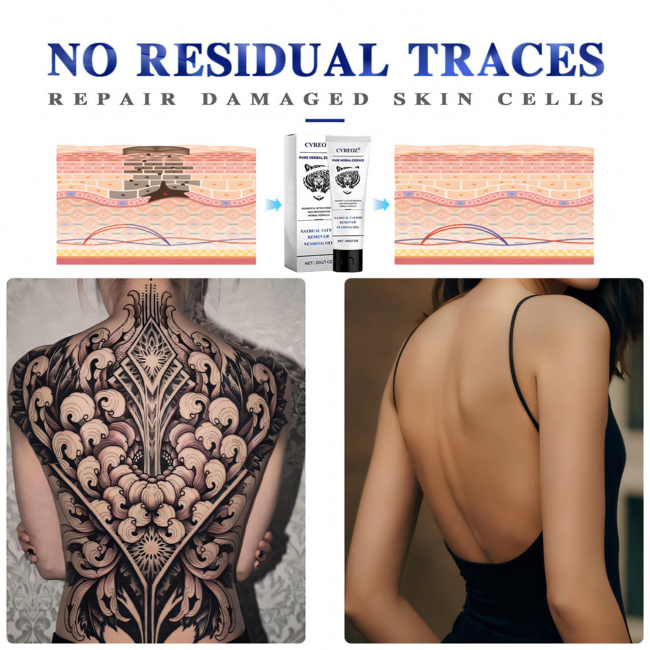 đLimited Offer 60% OFF - CrveozÂź Natural Tattoo Removal Numbing Gel