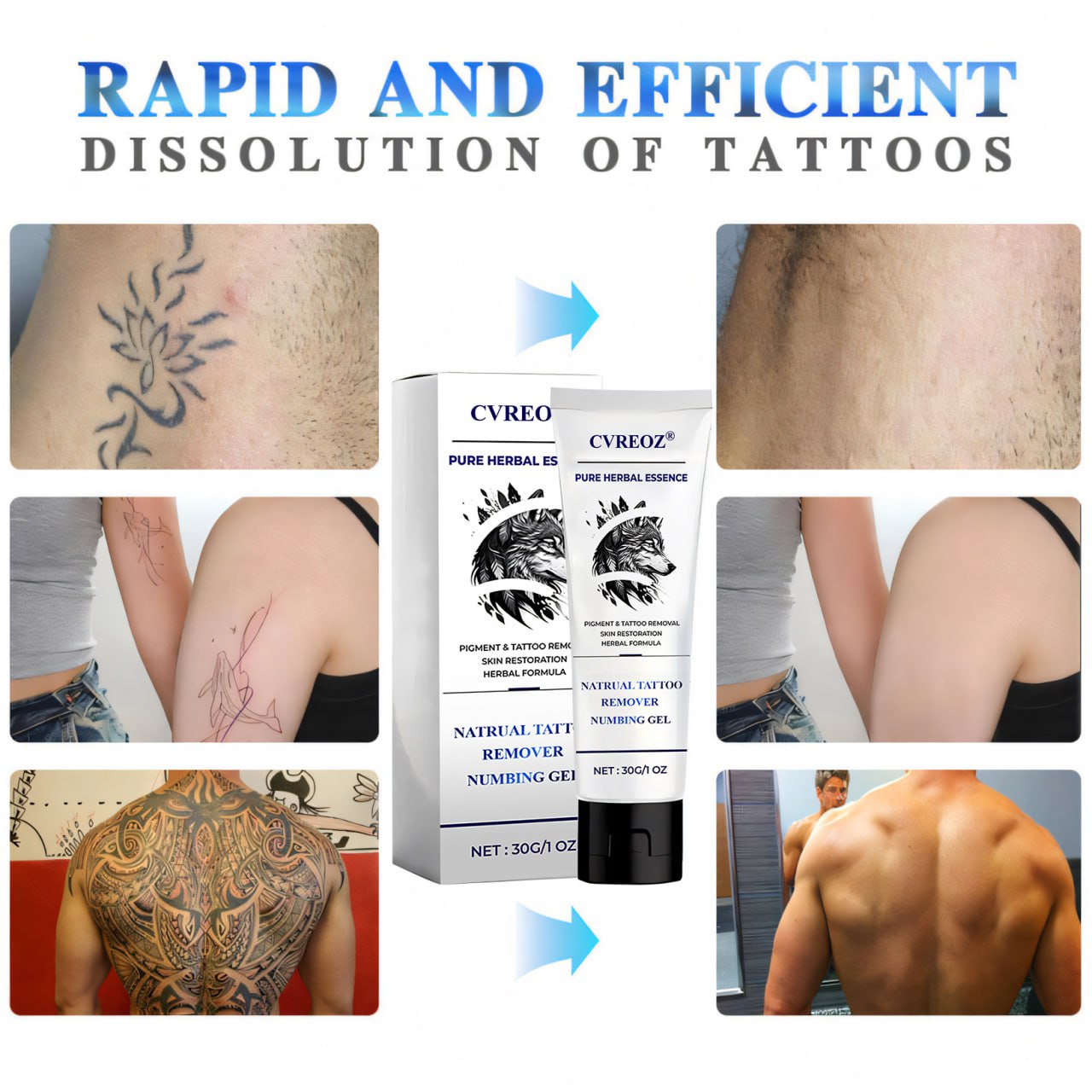 đLimited Offer 60% OFF - CrveozÂź Natural Tattoo Removal Numbing Gel