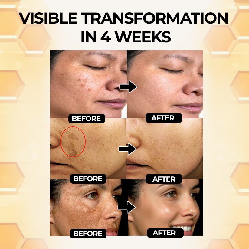š„LIMITED TIME OFFER 60% OFF! š„ CrveozĀ® Herbal Glow Melanin Correcting Face Serum