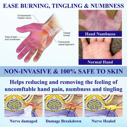 🔥Limited-Time Offer – 60%: Cvreoz® NumbAway CoolEase Neuropathy Spray