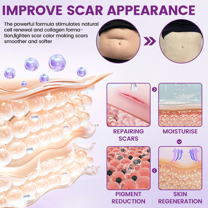 Cvreoz® ScarVanisher Scar Gel
