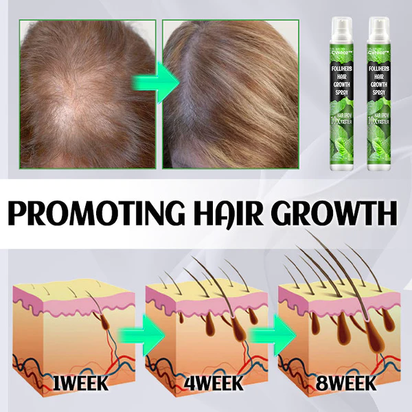 Cvreoz™ FolliHerb Hair Growth Spray 💥🔥 60% OFF - Grab it before it’s gone! ⚡💥