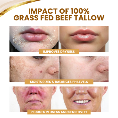 Cvreoz® DermSerene Beef Tallow Honey Balm