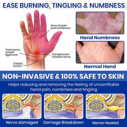 🦵🏻 CVREOZ® NumbEase Neuropathy Treatment Spray 💙 HOT SALE 60% OFF 🔥