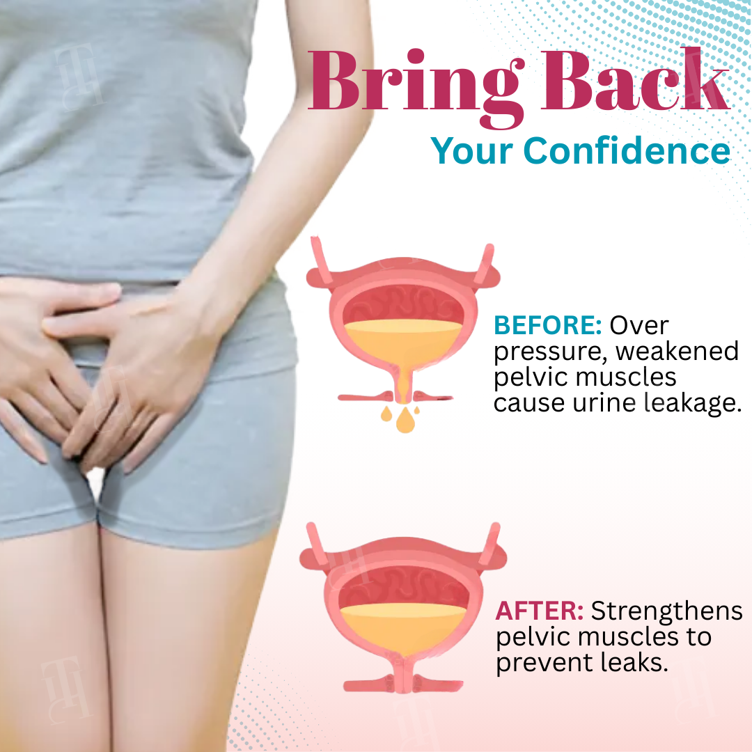 Cvreoz® BladderEase Patch✨𝐅𝐢𝐱 𝐔𝐫𝐢𝐧𝐚𝐫𝐲 𝐋𝐞𝐚𝐤𝐚𝐠𝐞 𝐢𝐧 𝐉𝐮𝐬𝐭 𝟏𝟒 𝐃𝐚𝐲𝐬!✨
