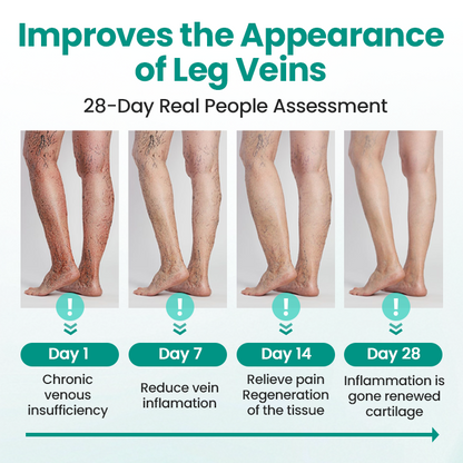 🎉SPECIAL OFFER: 60% OFF This Today Only!🔥 Cvreoz® LegRenew Varicose Veins Patch