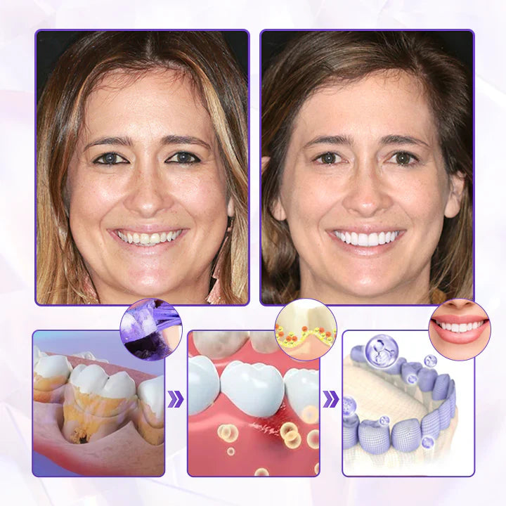 Cvreoz® BeeRenew Advanced Gum Healing Toothpaste