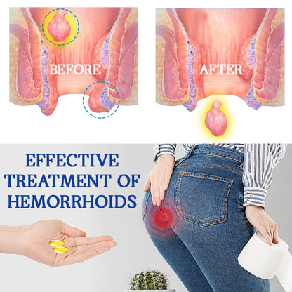 Cvreoz™ Natural Herbal Strength Hemorrhoid Capsules🌿⏳ 60% Off—Only 10 Minutes Left! 💰