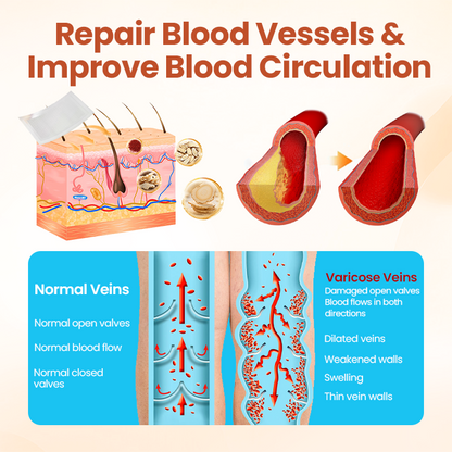 🔥CHRISTMAS SALE: 60% OFF Today ONLY!🔥 Cvreoz® VeinTarget Microneedle Care Patch