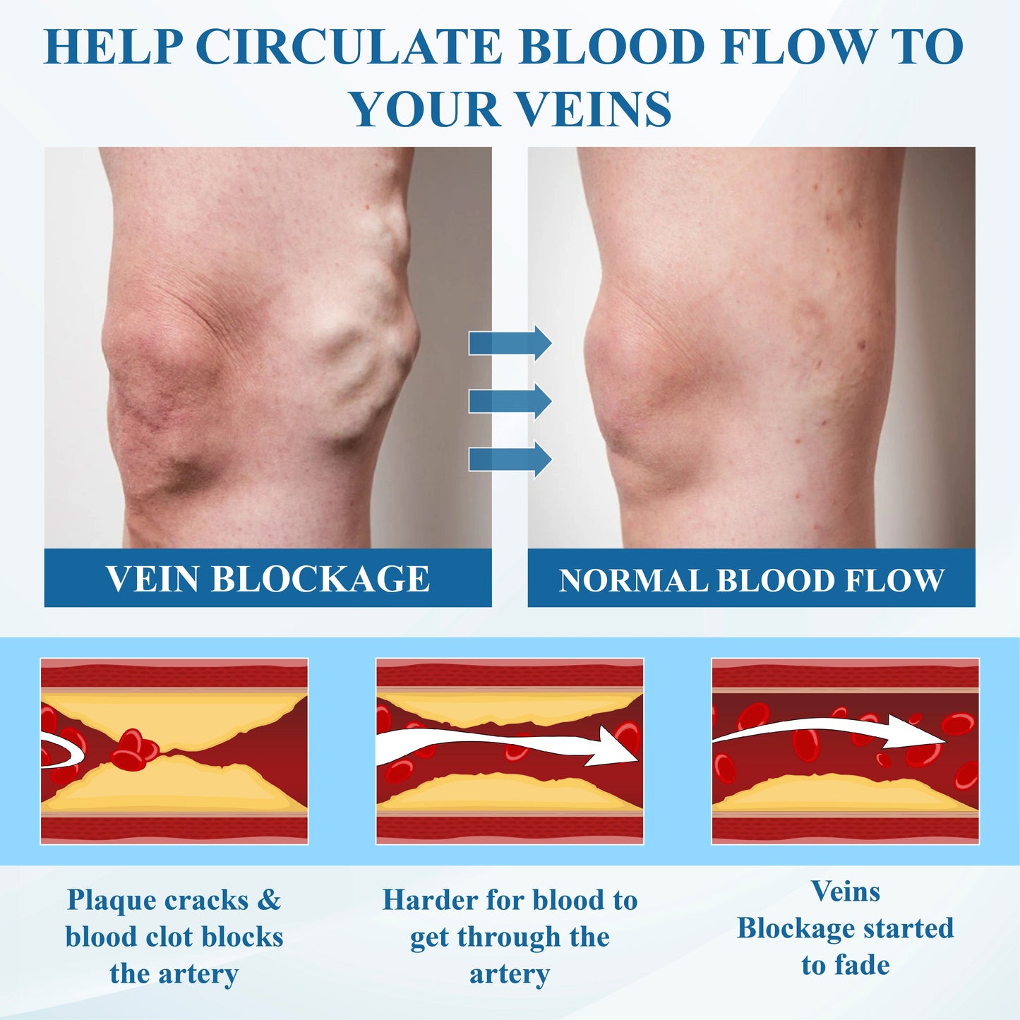 Cvreoz® VeinFocus Microneedle Leg Patch