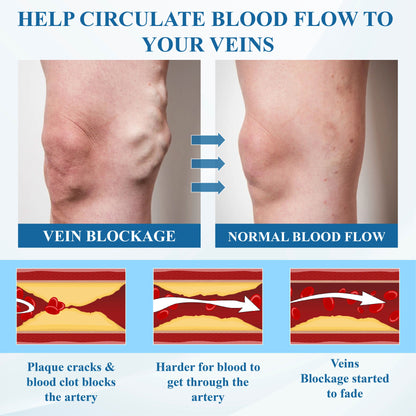 Cvreoz® VeinFocus Microneedle Leg Patch