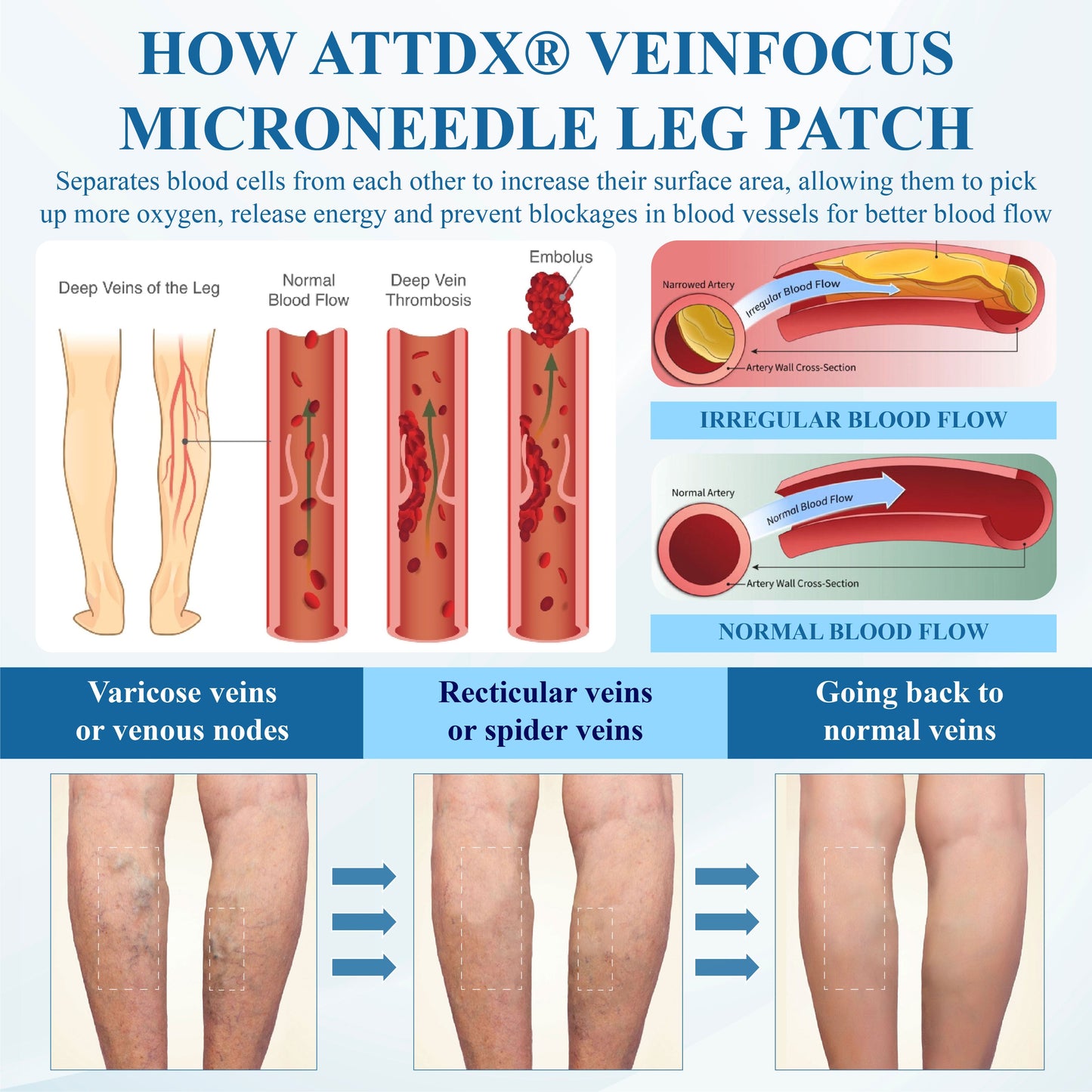 Cvreoz® VeinFocus Microneedle Leg Patch