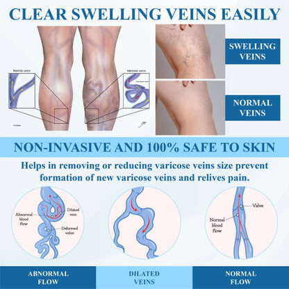 Cvreoz® VeinFocus Microneedle Leg Patch