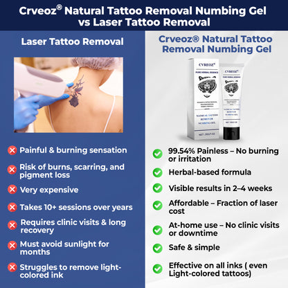 💖Limited Offer 60% OFF - Crveoz® Natural Tattoo Removal Numbing Gel