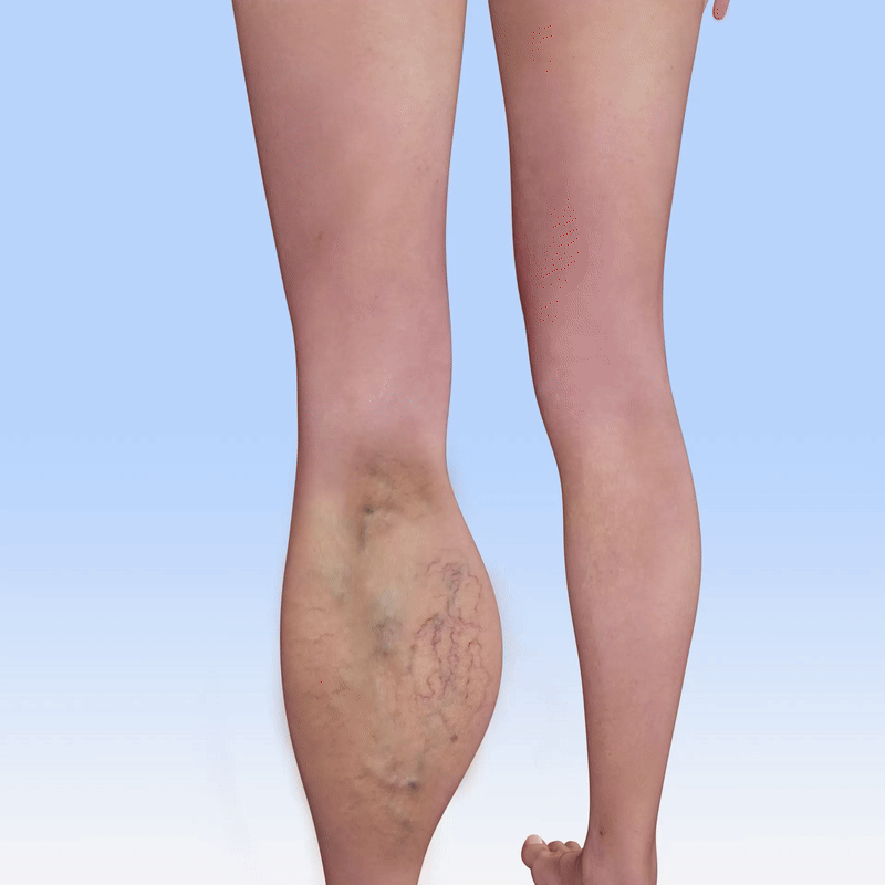 ⏰LIMITED OFFER 🦵🏻 CVREOZ® VeinSoothe Magnesium Relief Spray 💚