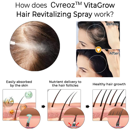 CVREOZ™ VitaGrow Hair Revitalizing Spray