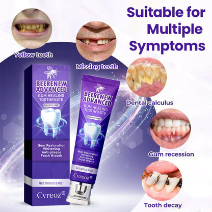 Cvreoz® BeeRenew Advanced Gum Healing Toothpaste