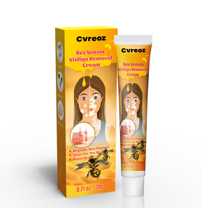 Cvreoz BeeVenom Vitiligo Remove Cream ⏰ Don't Wait - Last Day Sale Off 70% 💥