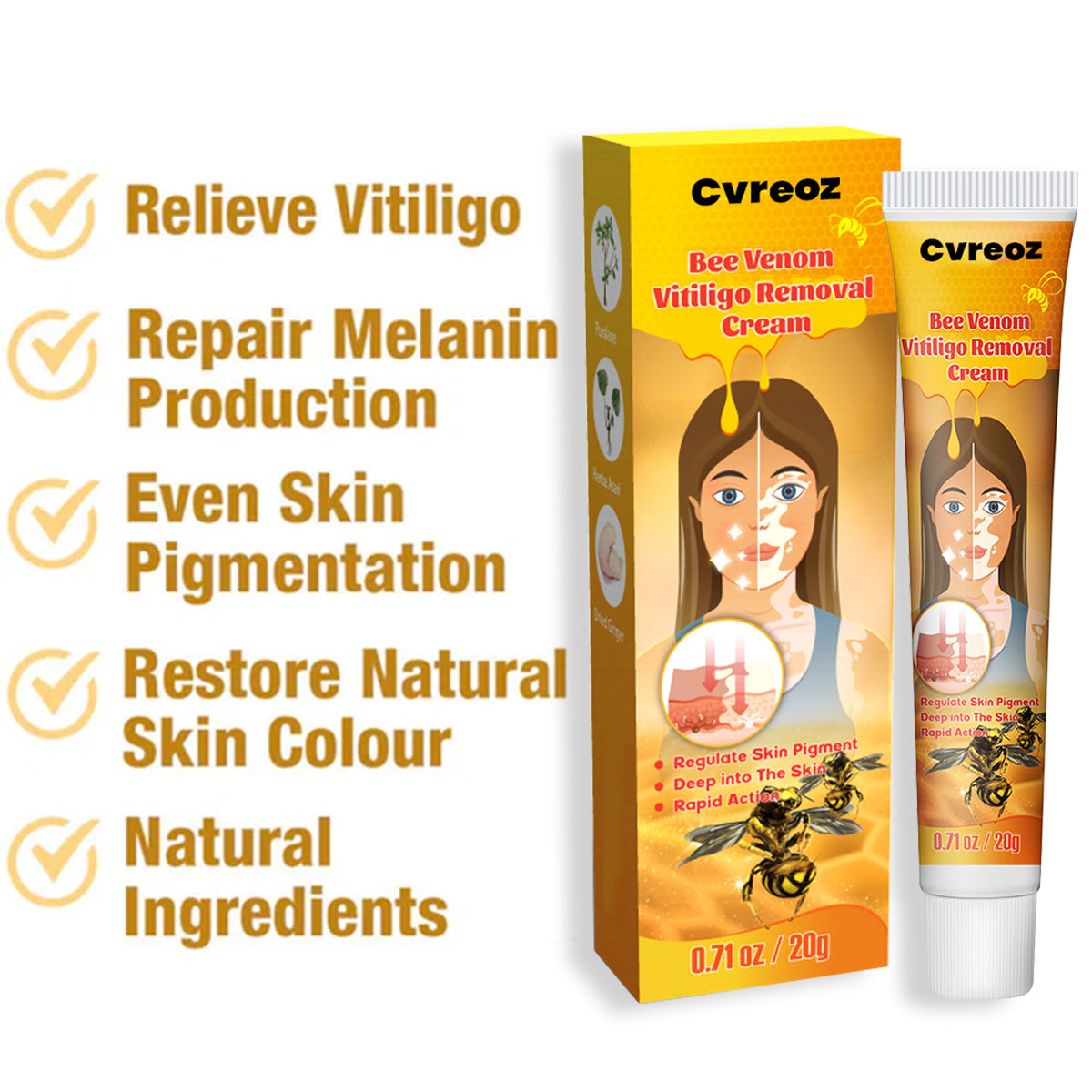 Cvreoz BeeVenom Vitiligo Remove Cream ⏰ Don't Wait - Last Day Sale Off 70% 💥