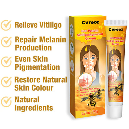 Cvreoz BeeVenom Vitiligo Remove Cream ⏰ Don't Wait - Last Day Sale Off 70% 💥