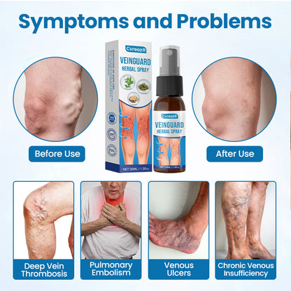 Cvreoz® VeinGuard Herbal Spray