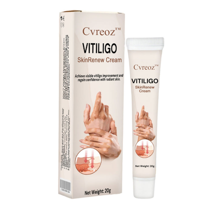 Cvreoz™ Vitiligo SkinRenew Cream 🔥 Save Big! 60% Off for a Limited Time! 🔥