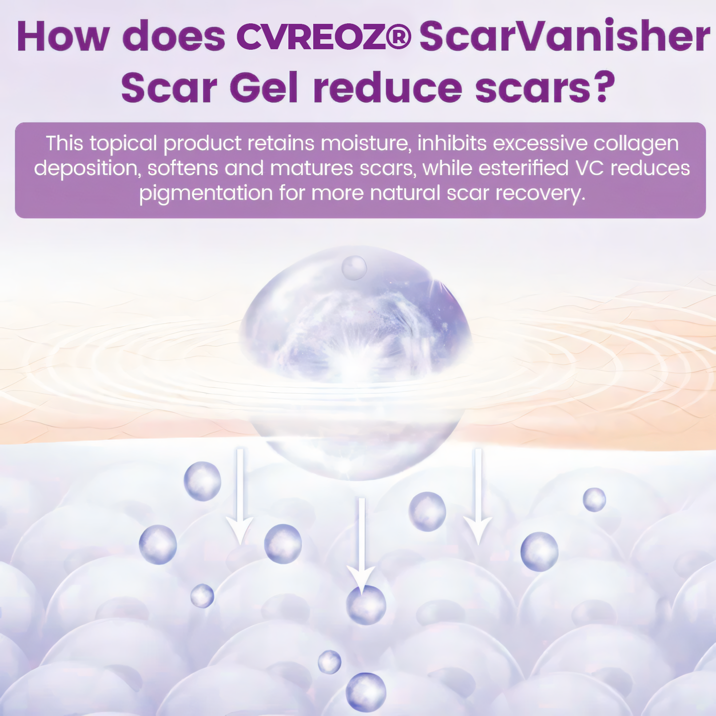 Cvreoz® ScarVanisher Scar Gel