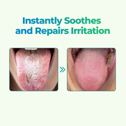 👅CVREOZ® GlosShield Tongue Repair Spray🔥HOT SALE: 60% OFF + FREESHIPPING🔥