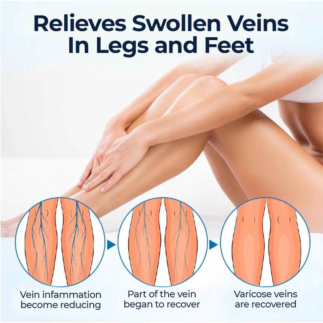 🎉LIMITED OFFER: 60% OFF This Week Only!🔥Cvreoz® Varicose Vein Health Care Spray