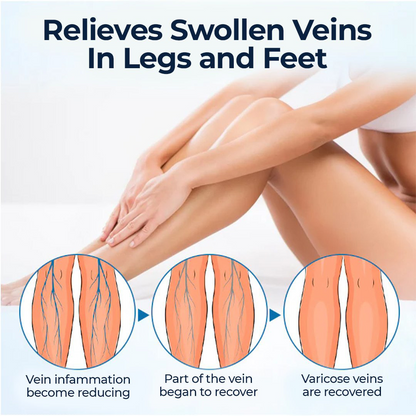 🎉LIMITED OFFER: 60% OFF This Week Only!🔥Cvreoz® Varicose Vein Health Care Spray