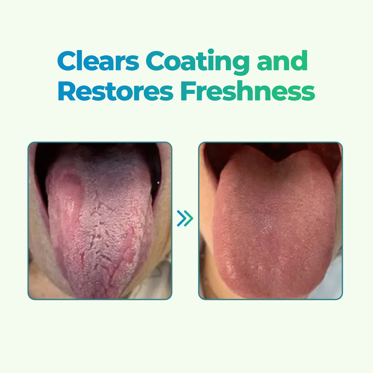 👅CVREOZ® GlosShield Tongue Repair Spray🔥HOT SALE: 60% OFF + FREESHIPPING🔥