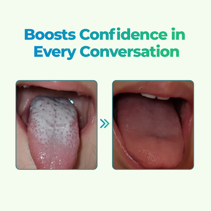 🔥 Special Deal: 60% OFF ⏰ CVREOZ® GlosShield Tongue Repair Spray 👅