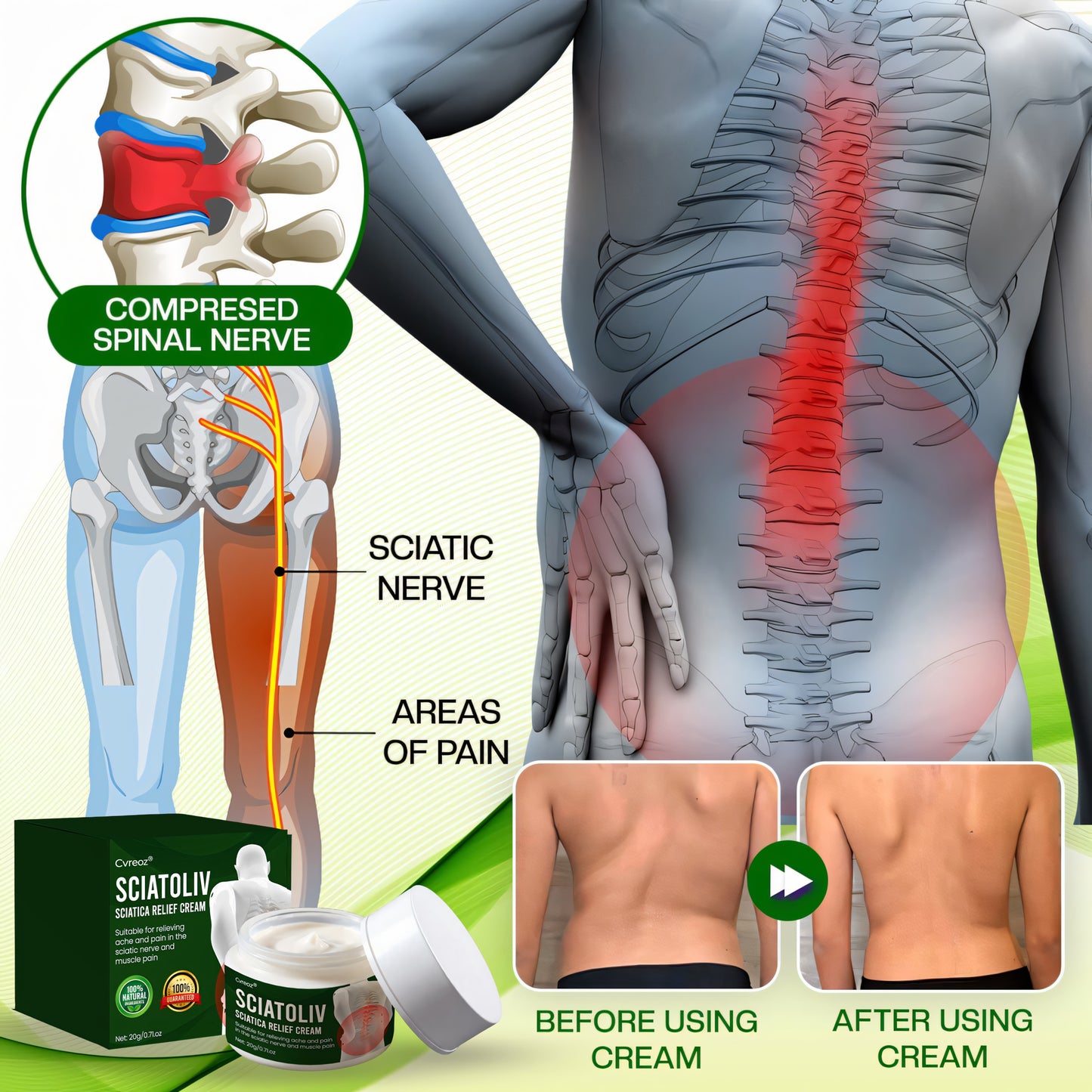 ✨ Special Launch Offer – 60% OFF Today ✨ Cvreoz® Sciatoliv Sciatica Relief Cream