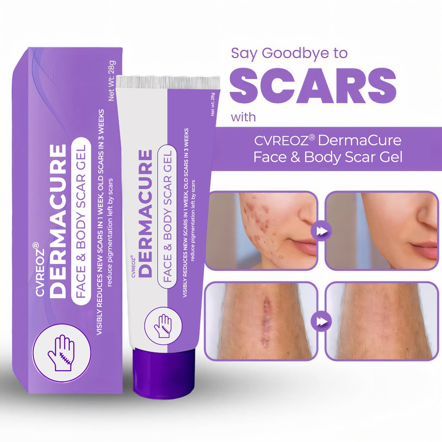 💜 CVREOZ® DermaCure Face & Body Scar Gel 🌷 HOT SALE 60% 🔥
