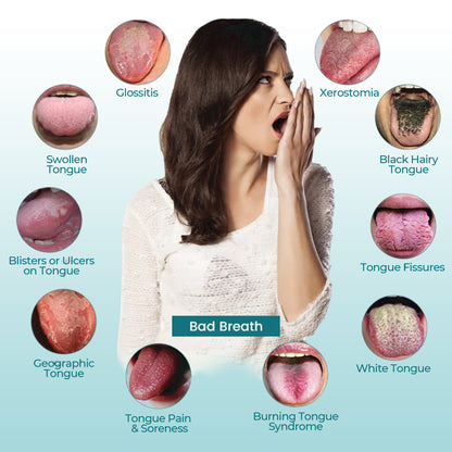 👅 CVREOZ® OralGuard Tongue Repair Spray