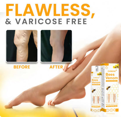 Cvreoz® Bees Venom Varicose Veins Spray