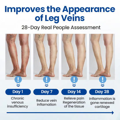 Cvreoz® Varicose Veins Patch🔥Last Sale: 60% OFF⏰